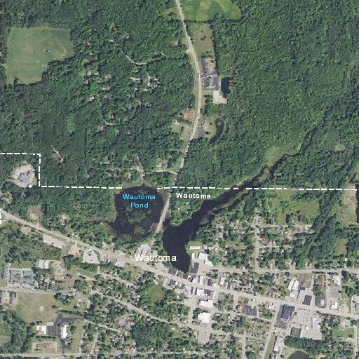 Man with rib pain after sneezing at Casey's General Store