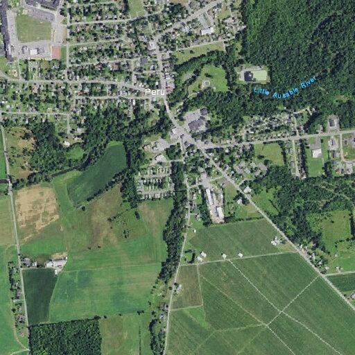 41-year-old female with right-sided weakness in Peru