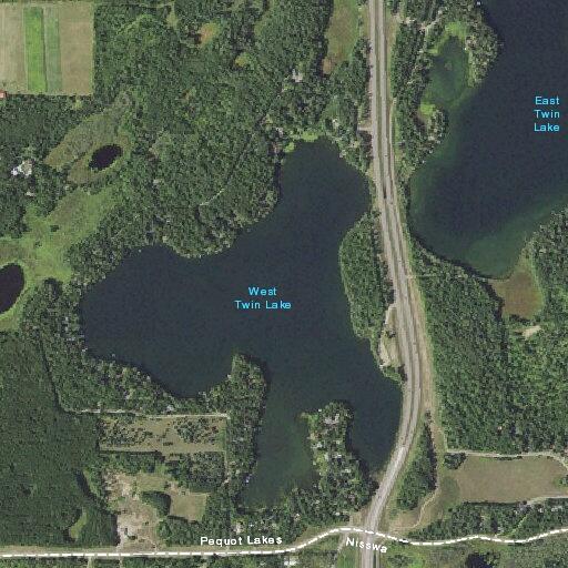 79-year-old male with chest pain in Pequot Lakes