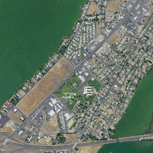 63-year-old man with weakness and swollen limbs in Moses Lake