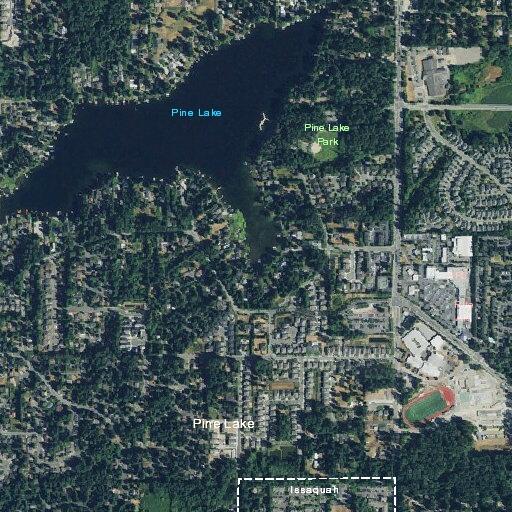 87-year-old male with hernia abdominal pain in Issaquah