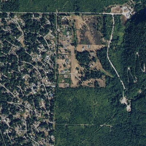 Person experiencing abdominal or back pain in Maple Falls