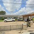 Man with facial and head pain after fall at senior living