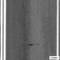 81-year-old man with altered mental status at clinic