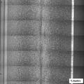 56-year-old woman treated for pain after a fall