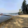 82-year-old man falls in campground with leg and hip pain