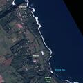 Person with leg swelling near Wailea Street