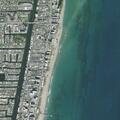 71-year-old man with low blood pressure at Beach House