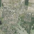 72-year-old man having heart attack in La Joya
