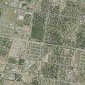 67-year-old woman bleeding from belly button in Edinburg