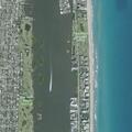 Person conscious with low blood pressure at Palm Beach
