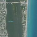 90-year-old man has low blood sugar at Palm Beach