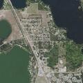 Person having cardiac chest pain at lake placid home