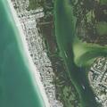 Person with abdominal pain at Bradenton Beach condo