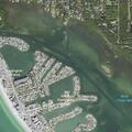 Person experiencing abdominal pain at Gulf Harbor Apartments