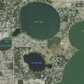 81-year-old woman has agonal breathing at home