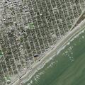 Elderly man reports pain from heel to abdomen at Galveston
