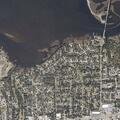 53-year-old woman with abdominal pain in Biloxi