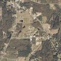 Man suffers severe abdominal pain in Soso, MS