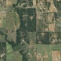 79-year-old man confused after heart surgery