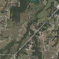 Woman with kidney stones treated near North FM 51 in Decatur