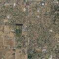 53-year-old woman with chest pain after car accident