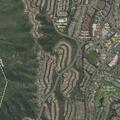 Person experiencing abdominal pain in Laguna Niguel