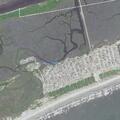 Intentional overdose near 36th Street in Sunset Beach