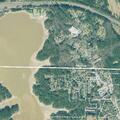 Woman vomiting and dizzy with chest pain in Acworth