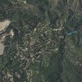Person bleeding at Cedar Drive in Lake Arrowhead