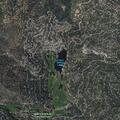 Person with abdominal pain at Tunnel Court in Lake Arrowhead