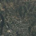 Person bleeding near Glacier Drive in Lake Arrowhead