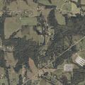 56-year-old woman with post-op pain on Alabama Highway 75