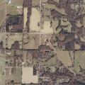 44-year-old man with diabetic issues on Lasso Circle