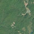 Person with fracture near Lake Drive in Mountain Rest