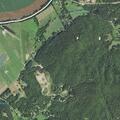 80-year-old man with abdominal pain in Brasstown