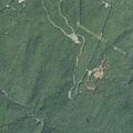 Woman with breathing difficulty and chest pain at Rainbow Falls
