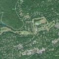 Person having seizure at golf club in Signal Mountain