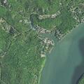 65-year-old woman with chest and jaw pain at Bamboo Trail
