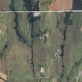 51-year-old female with pneumonia has chest pain and dizziness