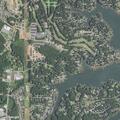 Man with back pain and dehydration near Lakeview Drive, Denver