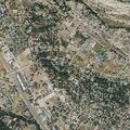 82-year-old woman coughing up blood in Atascadero