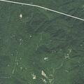 Person suffering possible kidney stone at Black Mountain