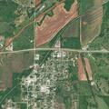 64-year-old woman with chest pain at North Cedar Street