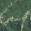 Pregnancy complications reported near North Fork Road