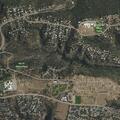 90-year-old man fell and is unresponsive with heart issues
