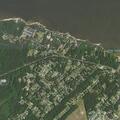 74-year-old woman with diabetic issues in Manteo