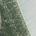 Woman with chest pressure and neck pain in Kitty Hawk