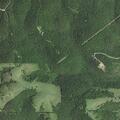 75-year-old woman suffers abdominal pain at home