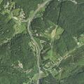 Person reporting severe back pain at Deep Gap Estates